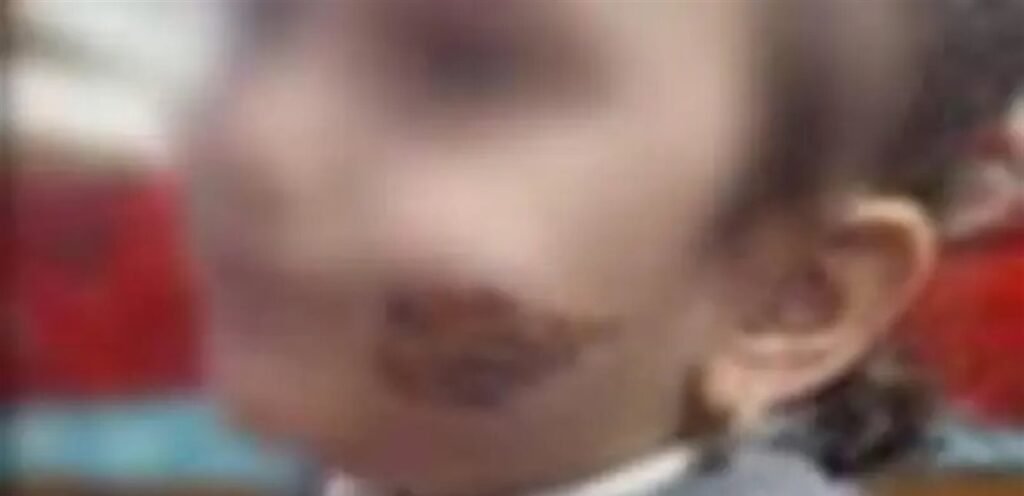 عذّبت طفلتها وشوّهت وجهها.. والسبب لا يخطر على البال!