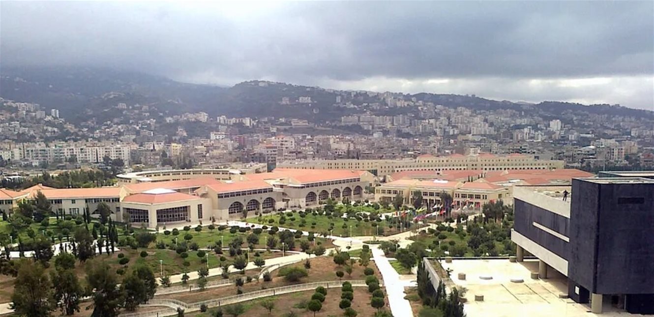 انجاز صحيّ جديد في “اللبنانية”.. بيان يكشف التفاصيل